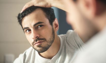 queda de cabelo calvície perda capilar