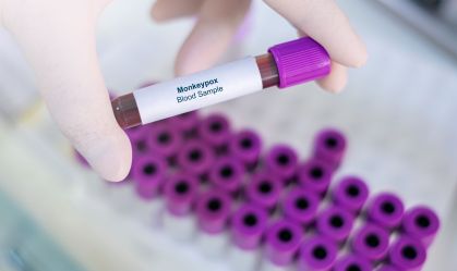 Especialista explica por que OMS deixou de classificar mpox como emergência de saúde global