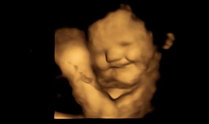 Fetap Study - Fetal and Neonatal Research Lab - Durham University