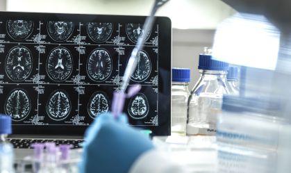 Casos de demência podem ser causados por doença no fígado, mostra estudo