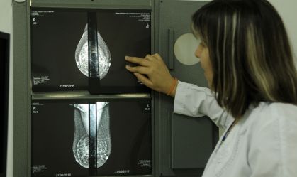 Outubro Rosa: o que se sabe sobre o câncer de mama avançado