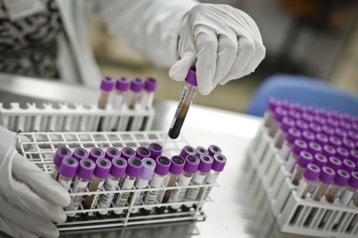 Coleta de amostra deve ser feita logo após a suspeita do diagnóstico / / Breno Esaki/Agência Saúde DF