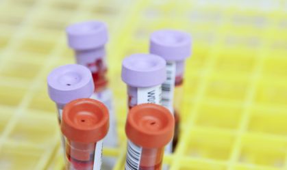 Mutirão da paternidade: instituto realiza exames de DNA gratuitamente todo fim de mês em SP