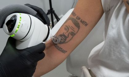 Estúdio de tatuagem irá remover tatuagens de Kanye West de graça