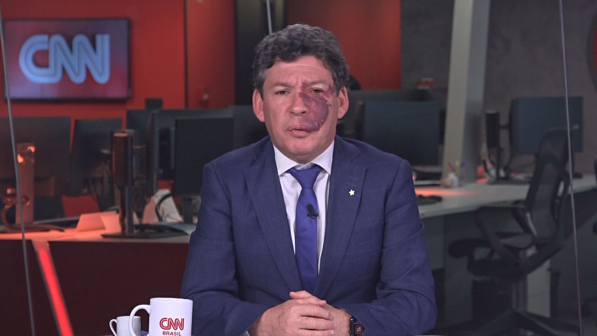 BR_CNN_161222_CONVIDADO_BRASILIA_frame_5487