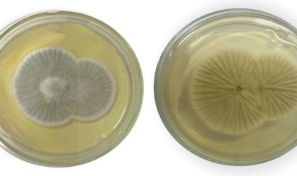 Fiocruz descreve 1º caso de meningoencefalite por fungo Penicillium chrysogenum no Brasil