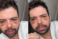 Em novo vídeo, humorista Gustavo Mendes admite que não foi vítima de assalto