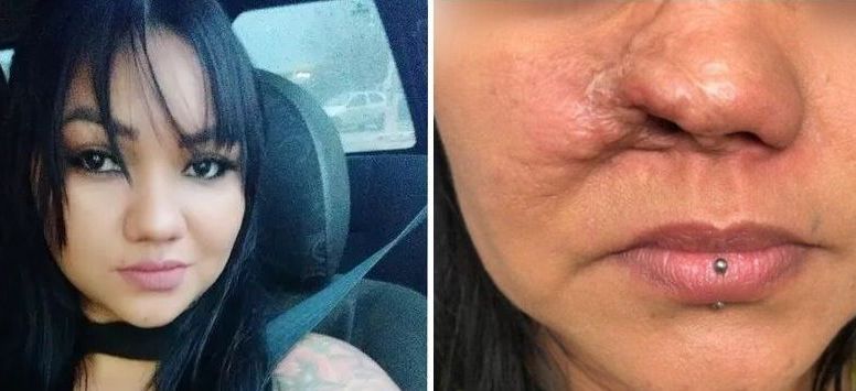 elielma-dentista-indiciado