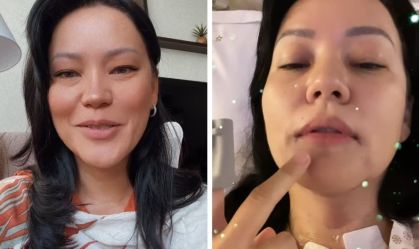 Geovanna Tominaga revela diagnóstico de tumor benigno: "Faça exames de rotina"