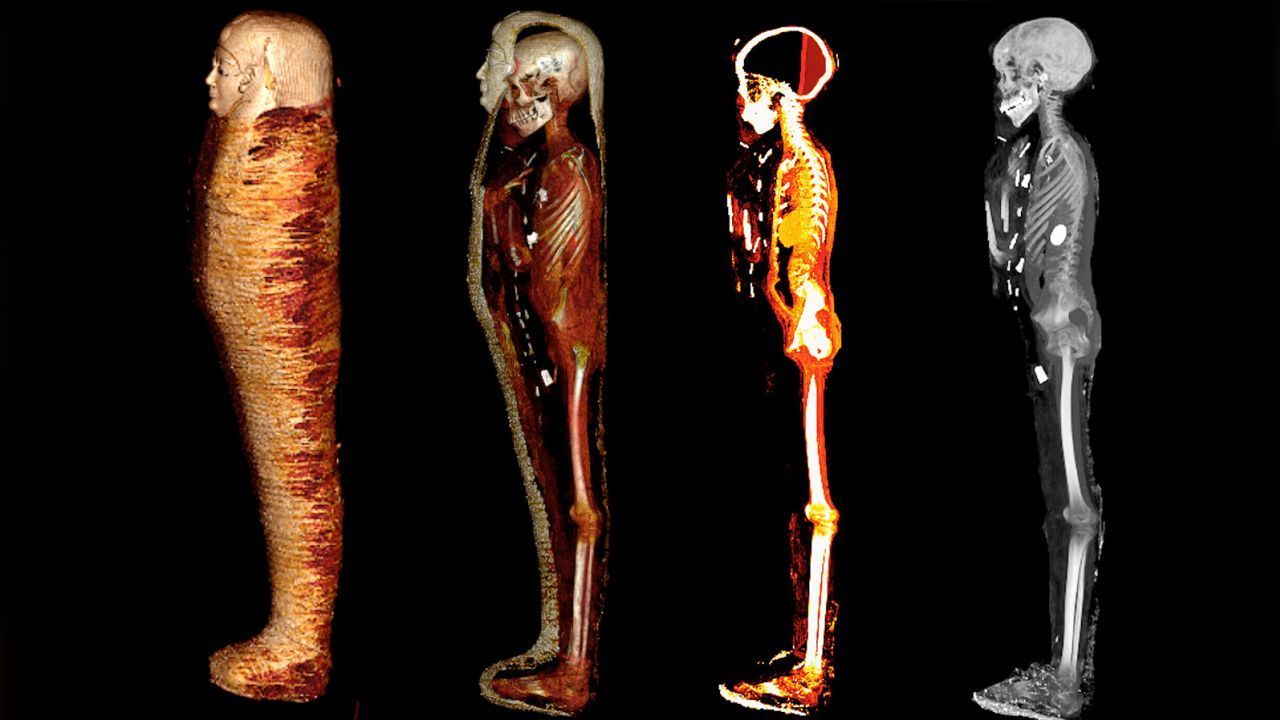Tomografias computadorizadas foram usadas para abrir virtualmente os restos mumificados / Frontiers Press