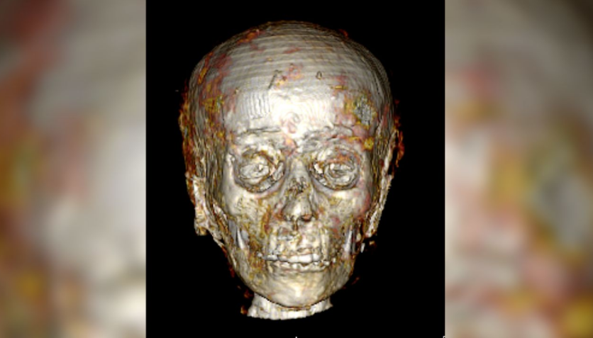 A digitalização revelou o rosto do menino de ouro, que não é visto há 2.300 anos / Frontiers Press