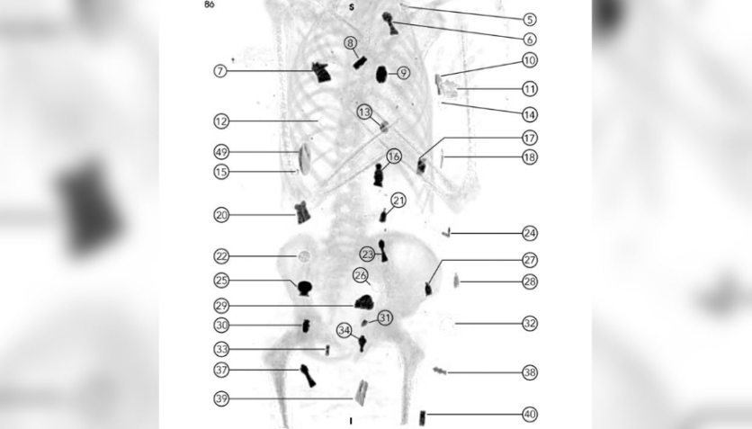 Amuletos foram colocados no corpo e colocados dentro dele / Frontiers Press