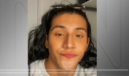 Influenciador com ceratocone