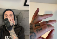 Show cancelado? Baterista do Blink 182 opera dedo e põe em dúvida vinda ao Brasil