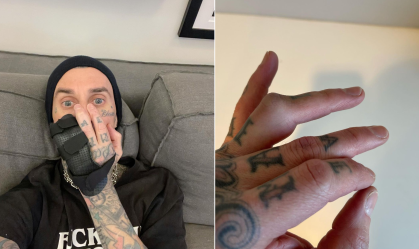Show cancelado? Baterista do Blink 182 opera dedo e põe em dúvida vinda ao Brasil
