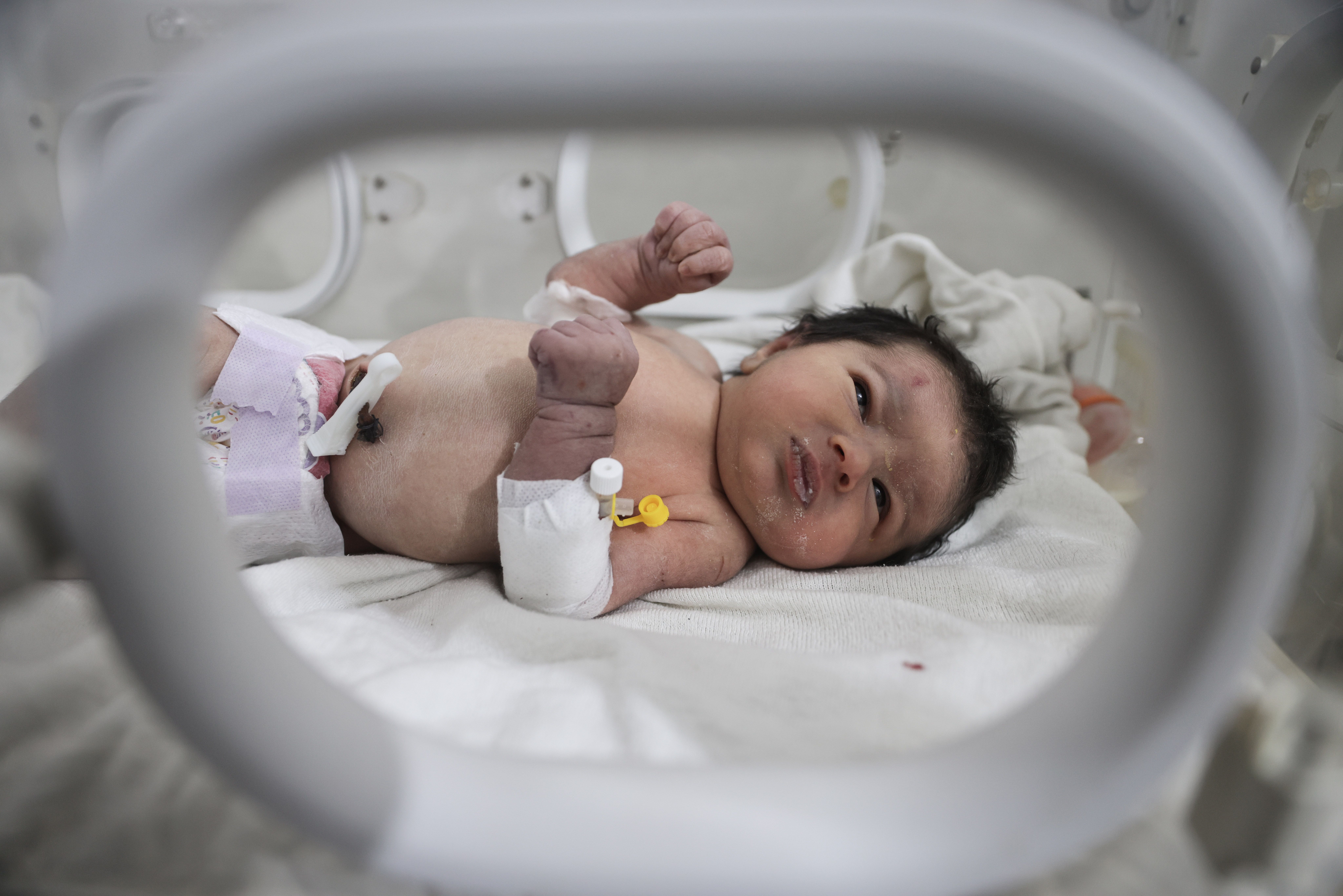 Aya, a chamada 'bebê milagrosa', foi resgatada debaixo de uma casa destruída, com o cordão umbilical ainda amarrado à mãe morta, após um terremoto mortal que destruiu a fronteira turco-síria / Anas Alkharboutli/picture alliance via Getty Images