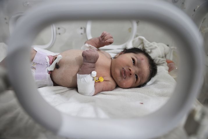 Aya, a chamada 'bebê milagrosa', foi resgatada debaixo de uma casa destruída, com o cordão umbilical ainda amarrado à mãe morta, após um terremoto mortal que destruiu a fronteira turco-síria / Anas Alkharboutli/picture alliance via Getty Images