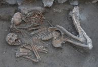 Homem de elite da Idade do Bronze fez cirurgia no cérebro há mais de 3.000 anos