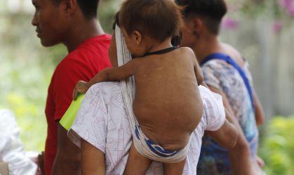 Mortes por desnutrição em terras Yanomami caem 68% em 2024, diz ministério