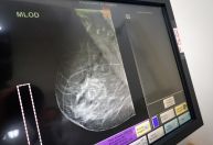 Outubro Rosa: ONG leva exames gratuitos para população vulnerável