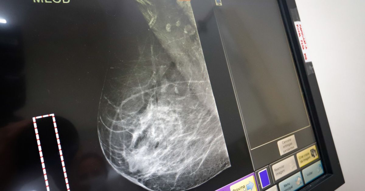 Outubro Rosa: ONG leva exames gratuitos