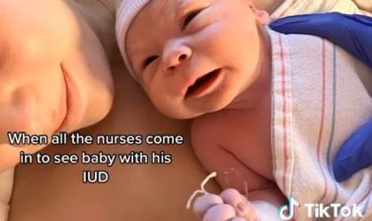 TikTok de bebê que nasceu segurando DIU viraliza