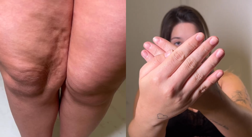 Ganho de celulite e unhas fracas foram algumas das mudanças que Viih revelou ter visto no corpo / Reprodução/Redes Sociais