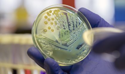 Superbactéria que representa risco de saúde global é detectada no Nordeste