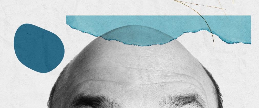 Calvície é um fator que afeta homens em todo o mundo / Reprodução CNN