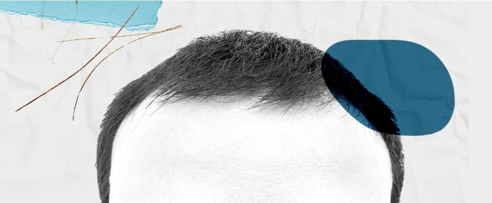 A arte de ficar careca graciosamente / Reprodução CNN