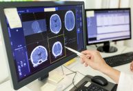 Instituto Butantan testa tratamento contra Alzheimer baseado em molécula modificada do peixe merluza