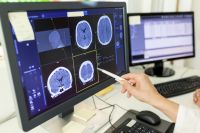 Tratamento de Alzheimer deve focar no sistema imune, sugere estudo da USP