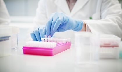 Teste rápido de tuberculose é indicado a pessoas com quadro grave de Aids; entenda