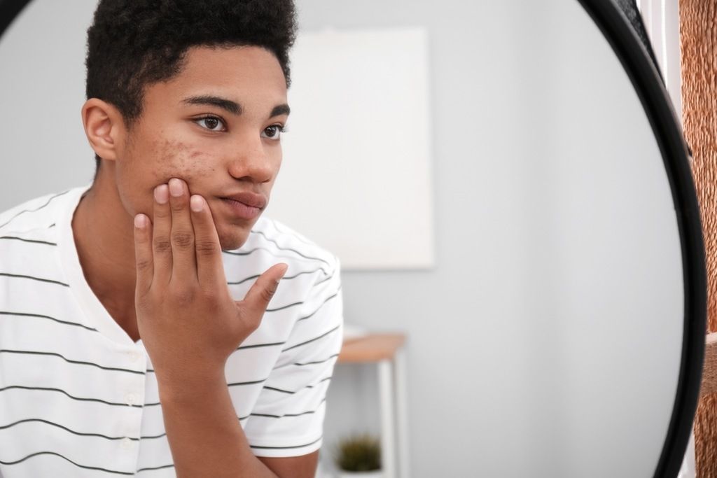 / Entenda o que é o efeito rebote na pele - Imagem: Shutterstock | Pixel-Shot
