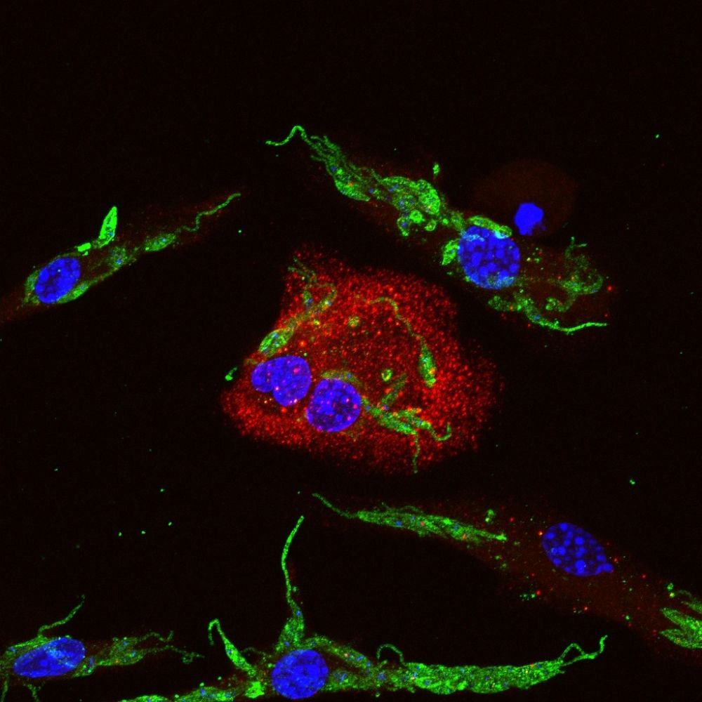 Técnica de imunofluorescência mostra macrófagos (em azul) infectados com Leishmania amazonensis (em verde)
