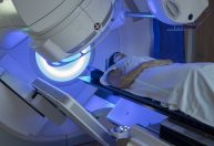 Entenda como funciona a radioterapia no tratamento do câncer