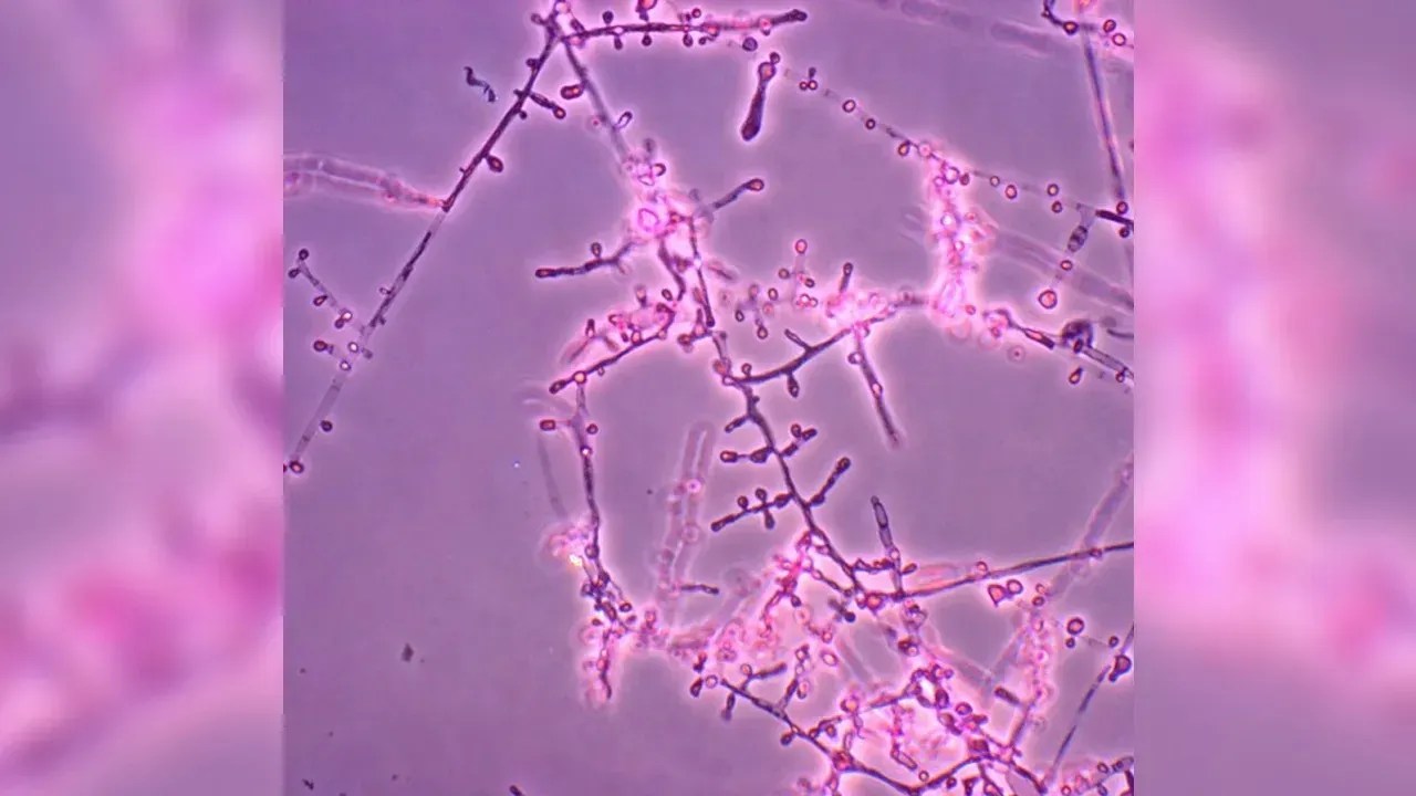 230511115514-treatment-resistant-ringworm