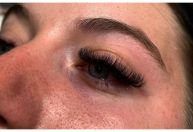Australiana sofre lesão na córnea após procedimento de extensão de cílios