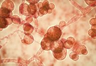 Superfungo: aumento de infecções pode ser causado por mudança climática, avaliam cientistas