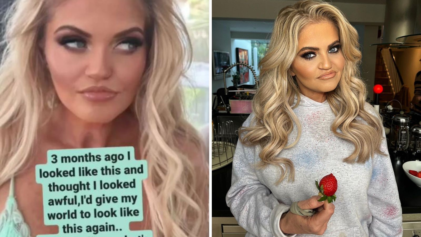 No Instagram, Danniella Westbrook desabafou sobre o resultado da cirurgia plástica / Reprodução/Daniella Westbrook/Instagram