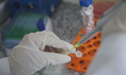 “Última cartada” da década, teste de vacina contra HIV é interrompido após resultados ruins