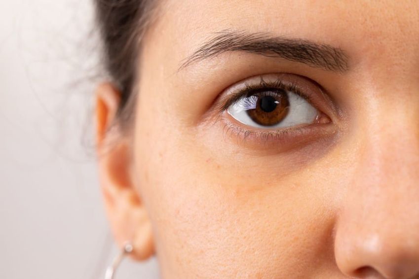 Por que temos olheiras? / Imagem: Shutterstock/sruilk