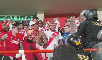 Torcedor do River Plate sofreu corte no rosto após briga com a polícia no Peru