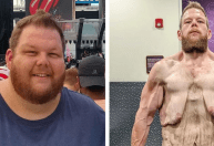 Americano perde mais de 160 kg e faz vaquinha para cirurgia de retirada de pele