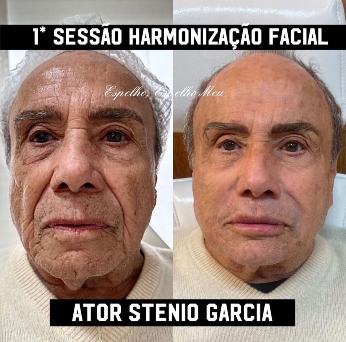 / Reprodução/Instagram