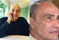 Aos 91 anos, Stênio Garcia passa por transformação e exibe harmonização facial