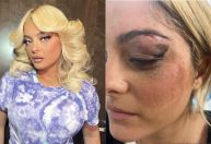 Bebe Rexha mostra rosto machucado após ser atingida por celular em show