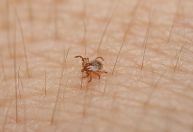 Febre maculosa: o que se sabe sobre o surto da doença após evento em Campinas (SP)
