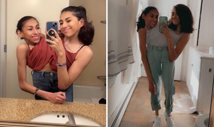 Conheça as gêmeas siamesas mexicanas de 22 anos que são sucesso no TikTok
