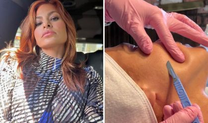 Eva Mendes diz que raspa os pelos faciais com frequência; entenda os riscos